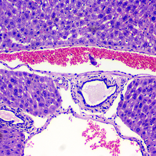 生物显微镜 - 病理