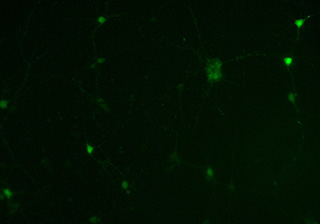 神经元荧光成像