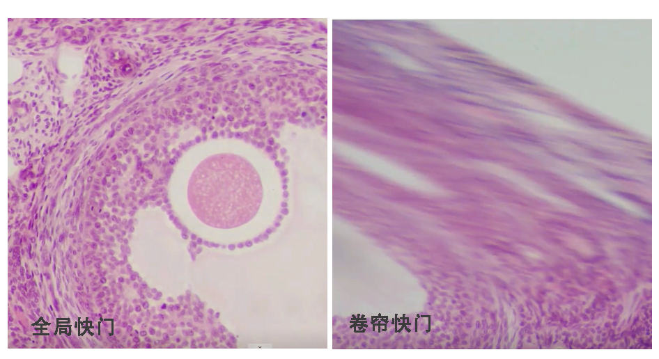 全局快门，拍摄更自然顺畅